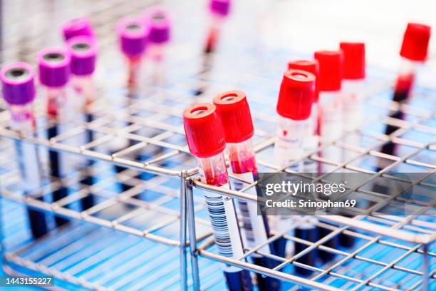 vascular testing in research laboratories - blood tubes stockfoto's en -beelden