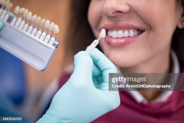 dentist using a palette tooth color sample. - porcelana imagens e fotografias de stock