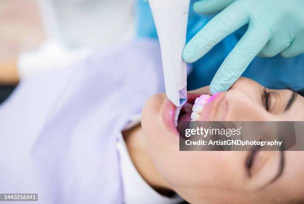 close up of dentist scanning patient's teeth with a 3d scanner. - 3d scanning stock pictures, royalty-free photos & images