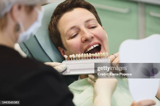 dentist and patient choosing color for implants at the clinic - implante imagens e fotografias de stock