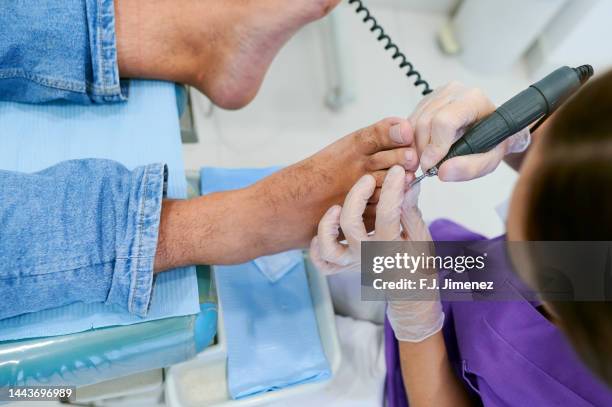 podiatrist file foot nail of patient in clinic - onicomicosi foto e immagini stock