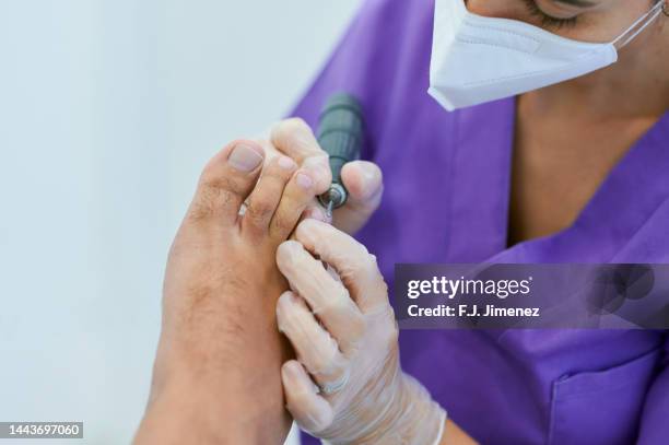 podiatrist file foot nail of patient in clinic - onychomycosis stock pictures, royalty-free photos & images