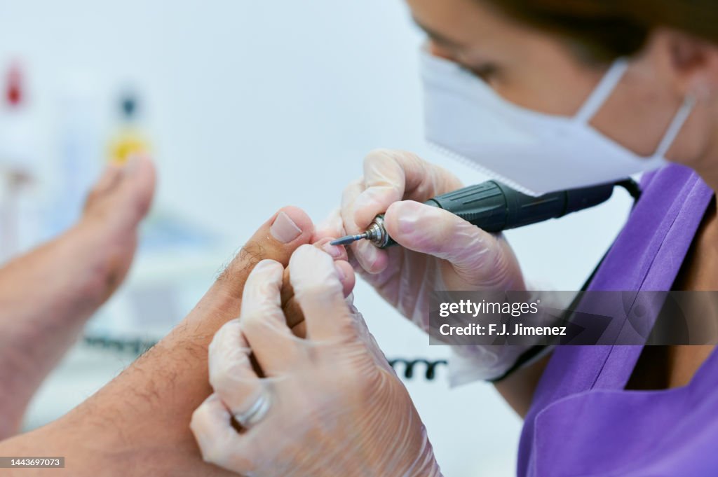 Podiatrist file foot nail of patient in clinic