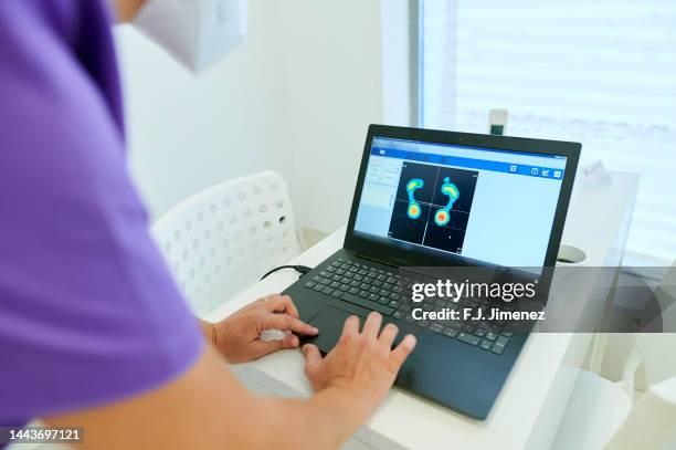 podiatrist looking at x-ray of patient's footprint - podiatrist stock-fotos und bilder