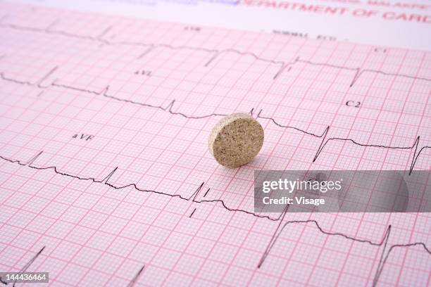 44 Ecg Graph Paper Stock Photos, High-Res Pictures, and Images - Getty ...