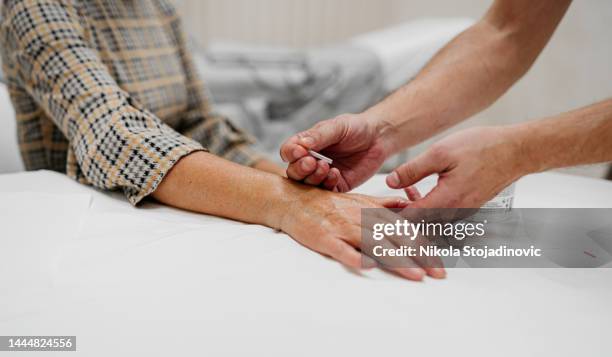 ago di agopuntura nella mano di una donna anziana - agopuntura foto e immagini stock