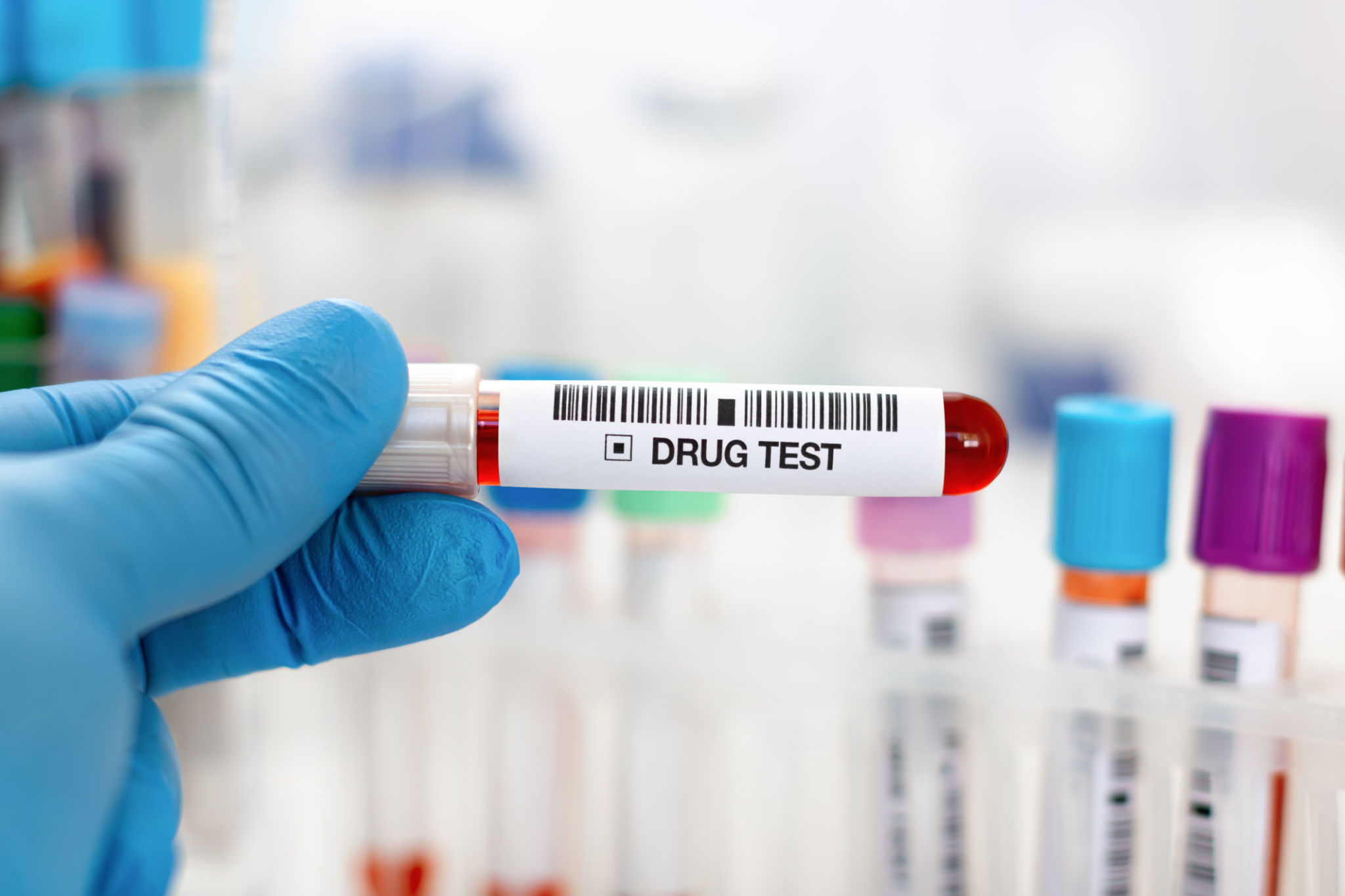 professional drug test