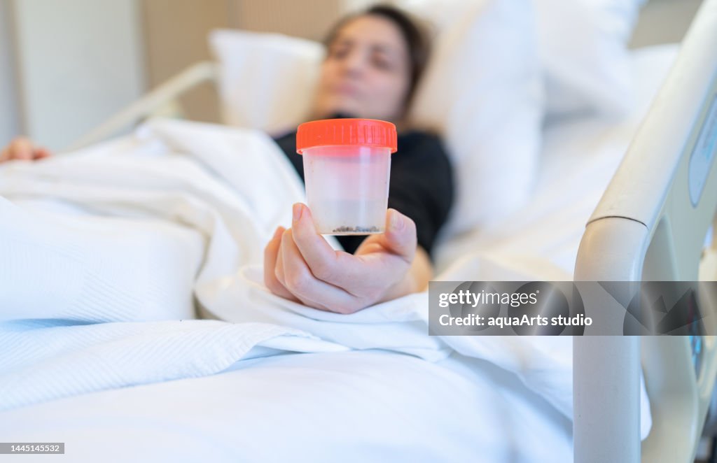 Female Patient Looking Her Gallstones After Surgery Operation