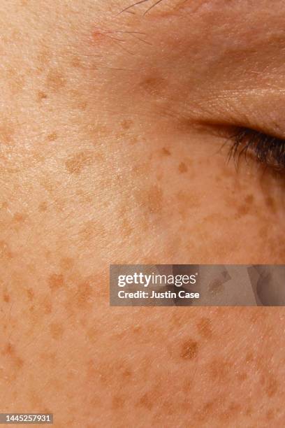 freckled face detail - freckle stock pictures, royalty-free photos & images