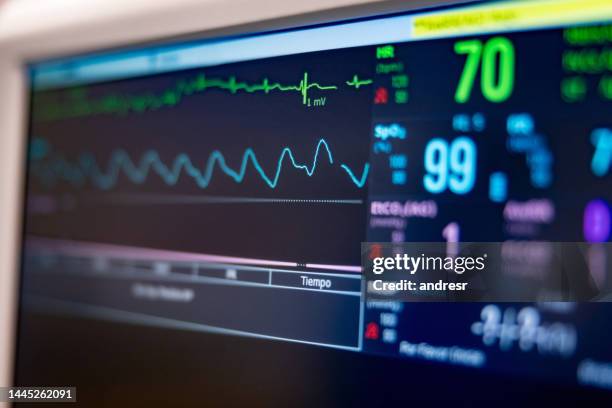 monitor at the hospital monitoring a patient's vitals - health technology bildbanksfoton och bilder