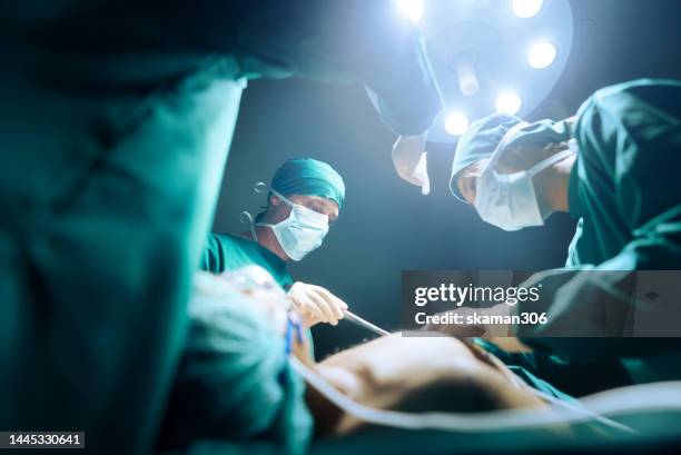 teamwork and cooperation three surgeons operating on a patient in the hospital's operating room - operationstisch stock-fotos und bilder