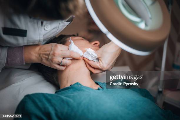 facial care against acnes and pimples. - pore strip stock pictures, royalty-free photos & images