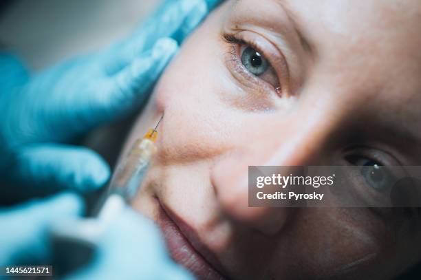 portrait d’une jeune femme sur une procédure d’injection de comblement du visage - acide hyaluronique photos et images de collection