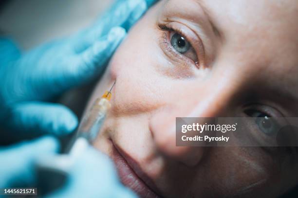 portrait of a young woman on a face filler injection procedure - ha stock pictures, royalty-free photos & images