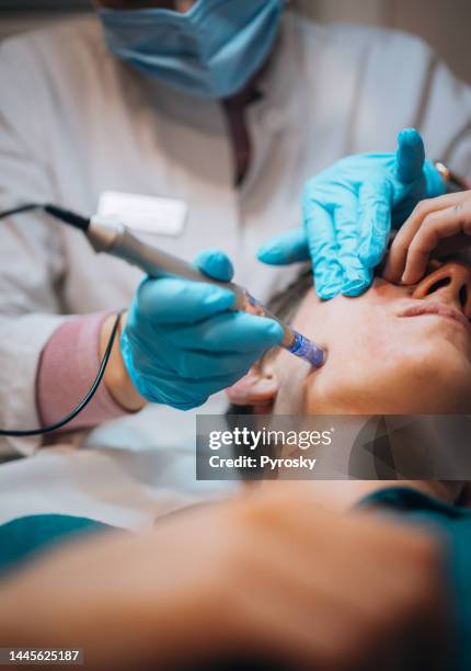 young man having dermapen micro-needling treatment - acupuncture needle stock pictures, royalty-free photos & images