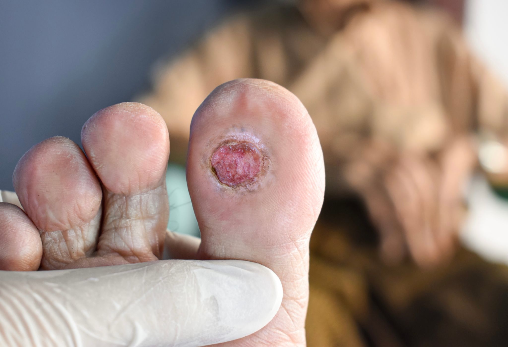 foot injury recovery