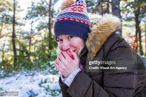 19 Visual Snow Syndrome Stock Photos, High-Res Pictures, and Images ...