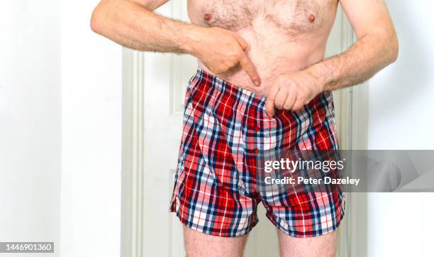 man pointing down his boxer shorts - condiloma fotografías e imágenes de stock