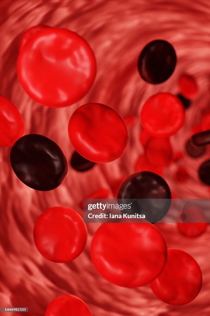 Red and black blood cells flowing through artery. Cholesterol and blood diseases concept. 3D vertical pattern.