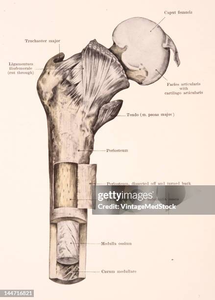 Medical illustration from 'Hand-Atlas of Human Anatomy, volume 1' shows the proximal part of a freshly prepared right femur of an adult. A piece of...