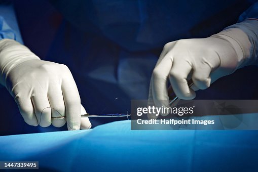 Close-up of surgeon hands during operation. Close-up of surgeon hands during operation.
