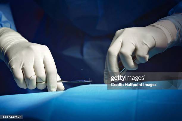 close-up of surgeon hands during operation. - surgical equipment stock pictures, royalty-free photos & images