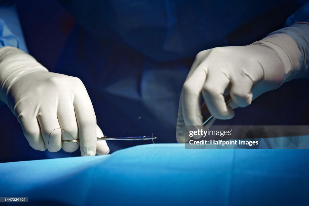 Close-up of surgeon hands during operation.