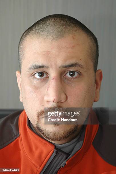 In this photo provided by State Attorney's Office in Florida, George Zimmerman is seen with his wounds on February 27, 2012 in Sanford, Florida....