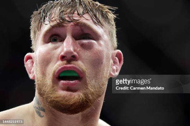 Darren Till of England reacts after being defeated via submission by Dricus Du Plessis of South Africa in a middleweight fight during the UFC 282...