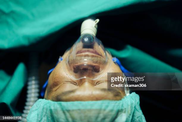 top view patient wearing an oxygen mask  and close your eye after surgeons operate on a patient in the hospital's operating room - anesthesia mask bildbanksfoton och bilder