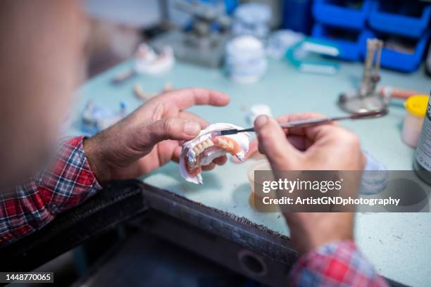 a prosthodontist working on dentures, dental technician repair dentures. - tandfyllning bildbanksfoton och bilder