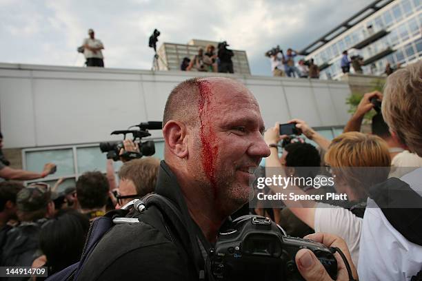 Getty Images photographer Scott Olson is seen with blood on his head after being hit by a baton by Chicago police during a protest near the Nato...