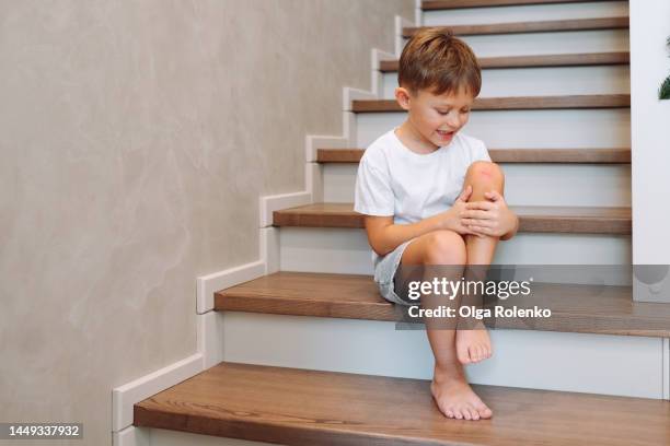 it hurts. sad boy holding his leg after getting injured on stairs - injured leg stock pictures, royalty-free photos & images