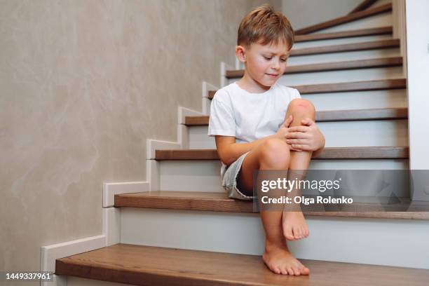 painful injury on boy knee. sad boy holding his leg after getting injured on stairs - injured leg stock pictures, royalty-free photos & images