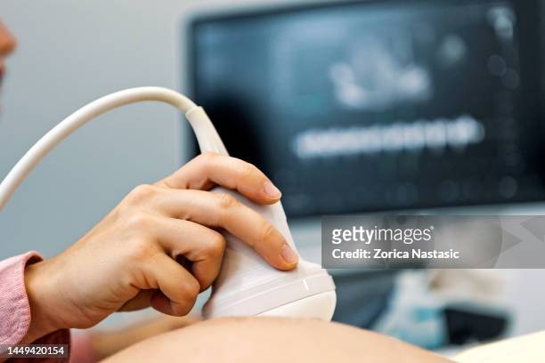 close up da mulher grávida com o médico - ultrasound scan - fotografias e filmes do acervo