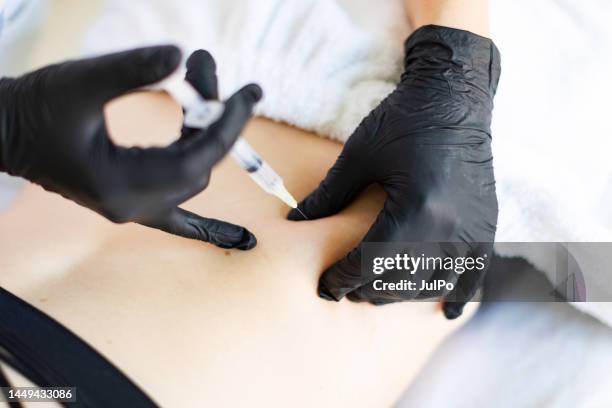 cosmetologo che fa iniezioni per la correzione del corpo - mesoterapia foto e immagini stock