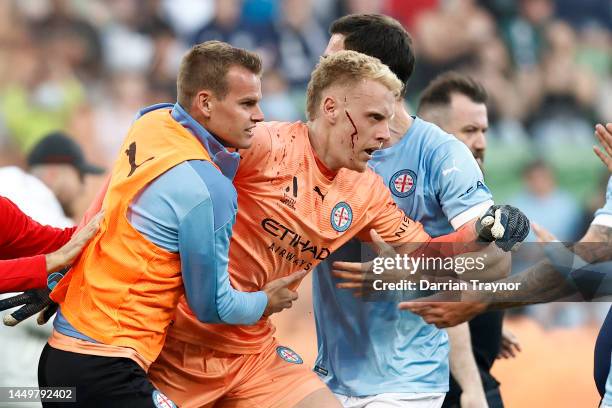 Bleeding Tom Glover of Melbourne City is escorted from the pitch by team mates after fans stormed the pitch during the round eight A-League Men's...