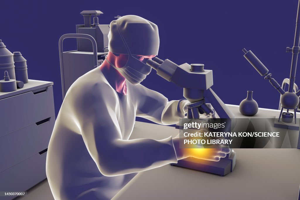 Carpal tunnel syndrome in laboratory workers, illustration