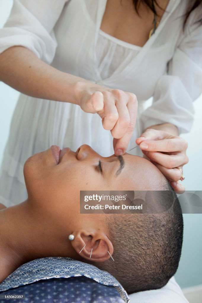 Black woman receiving acupuncture treatments