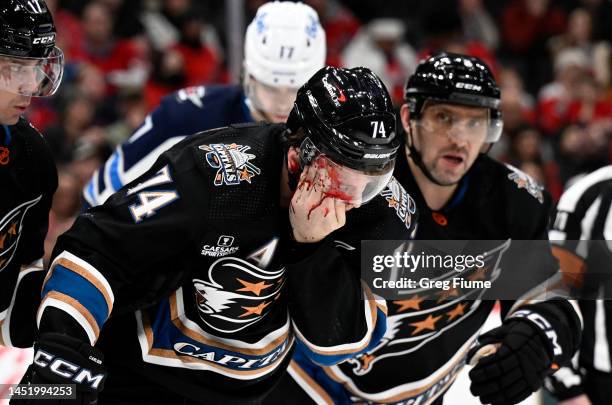 John Carlson of the Washington Capitals is helped off the ice after being hit with the puck in the third period against the Winnipeg Jets at Capital...