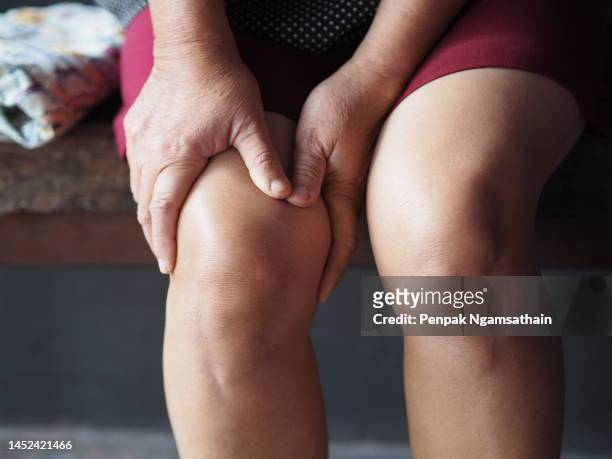 woman hands on knees - female knee pain stock-fotos und bilder