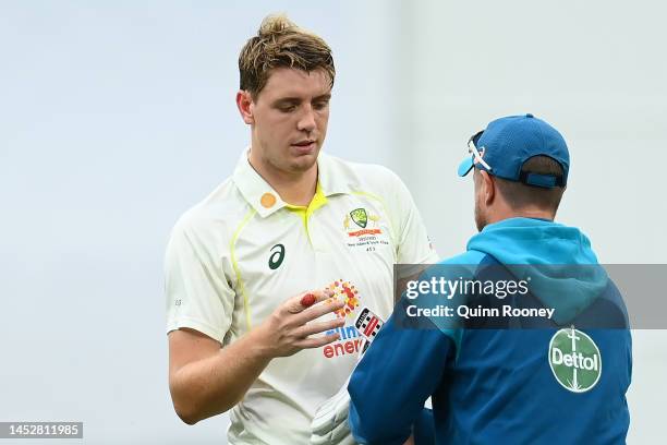 Cameron Green of Australia has his finger checked during day three of the Second Test match in the series between Australia and South Africa at...