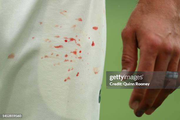 Blood stains are seen on the uniform of Mitchell Starc of Australia during day three of the Second Test match in the series between Australia and...