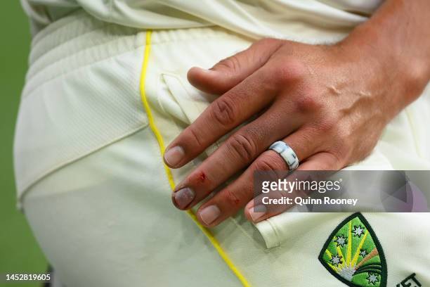 The hand of Mitchell Starc of Australia is seen during day three of the Second Test match in the series between Australia and South Africa at...