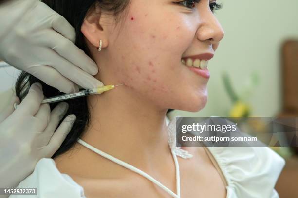 young woman in beauty clinic treating acne with injection - pore strip stock pictures, royalty-free photos & images