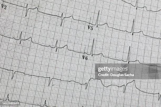 ekg - electrocardiogram (xxl) - prendre le pouls photos et images de collection
