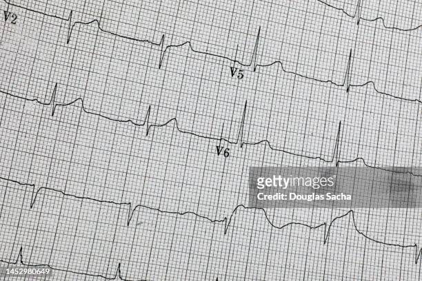 ekg - electrocardiogram (xxl) - 心臓刺激伝導系 ストックフォトと画像