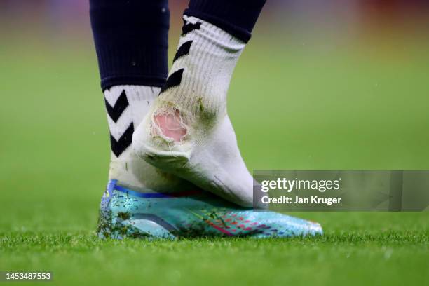 Detailed view of the socks of Nathan Patterson of Everton after a tackle during the Premier League match between Manchester City and Everton FC at...