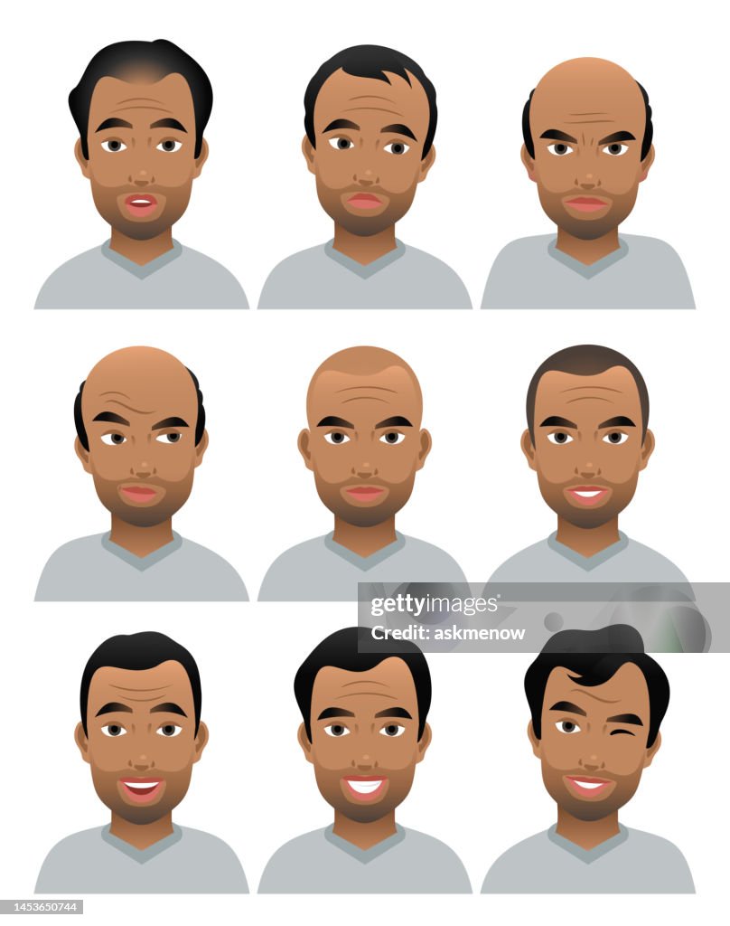 Balding man