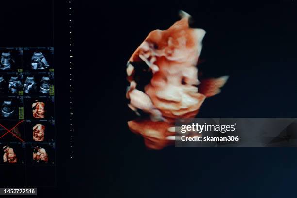 doctor used an ultrasound sonogram  monitor for  the fetus 30 weeks young adult patient pregnant - 20 week foetus stock pictures, royalty-free photos & images